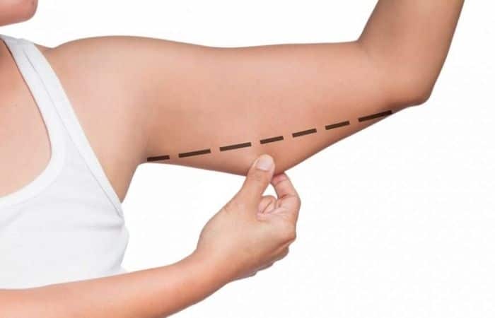 1 - بهترین روش اصلاح افتادگی بازو