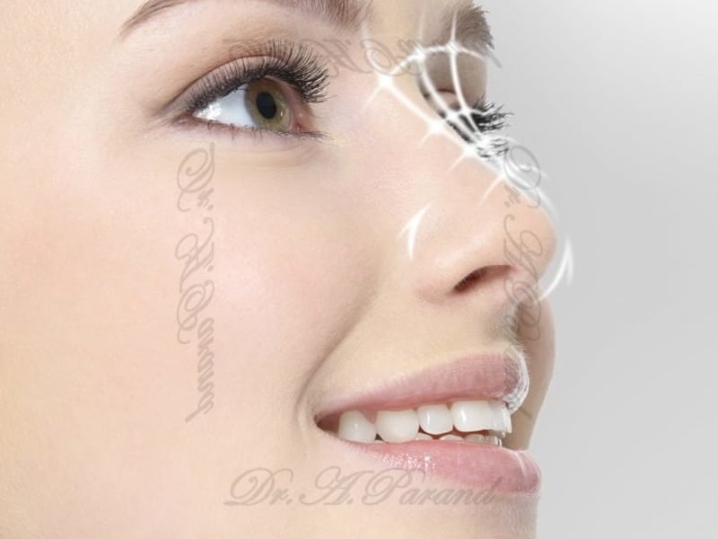 2 3 مهم ترین فاکتور زیبایی بینی در جراحی بینی