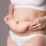 افتادگی شکم بعد از زایمان | علت - پیشگیری و درمان قطعی