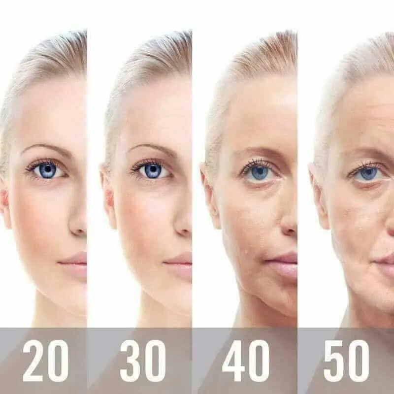 Facial Aging Illustration گودی زیر چشم | رفع با لیزر پلکسر