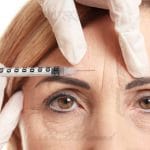 Botox | Use cases Advantages and care after injection