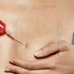 Fat injection into the breast Advantages and disadvantages of breast fat injection