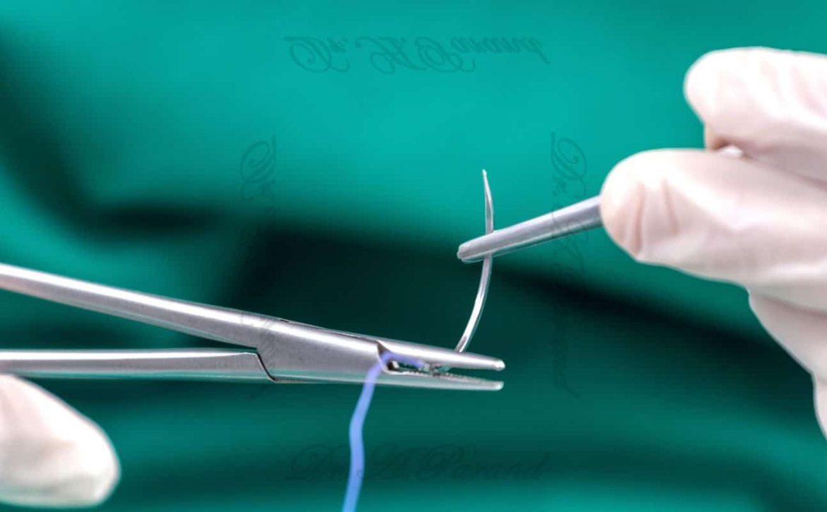 types of sutures e1710313212680 دکتر علی پرند فوق تخصص جراحی پلاستیک زیبایی و ترمیمی