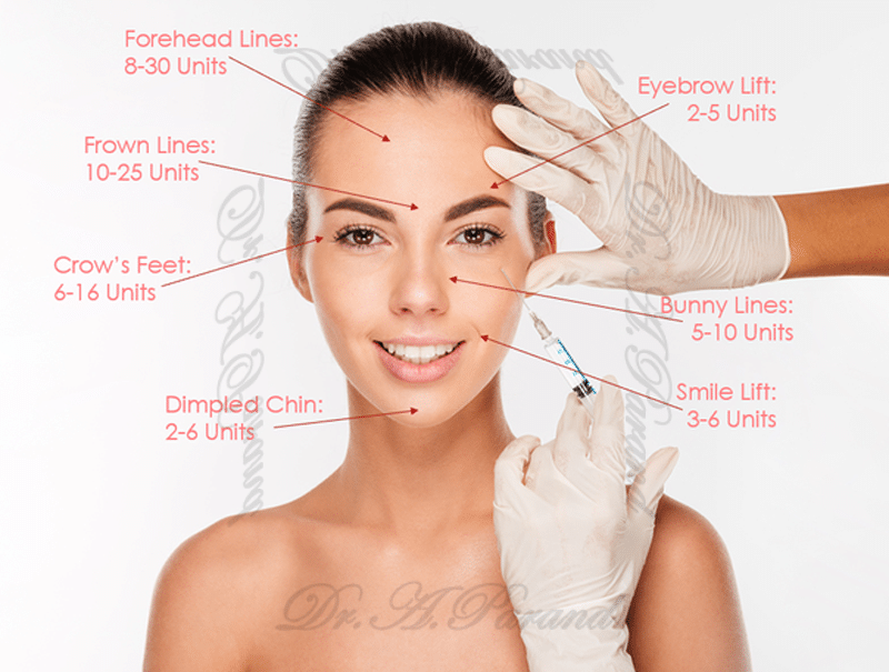 The cost of a forehead lift with Botox
