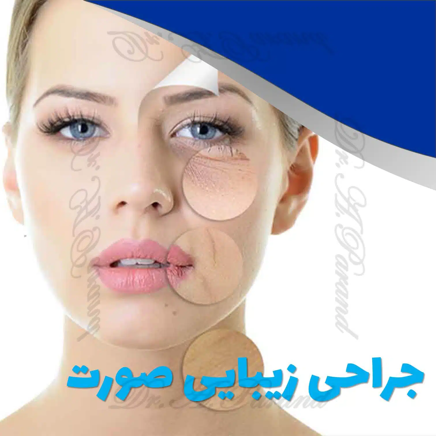 جراحی زیبایی صورت دکتر پرند