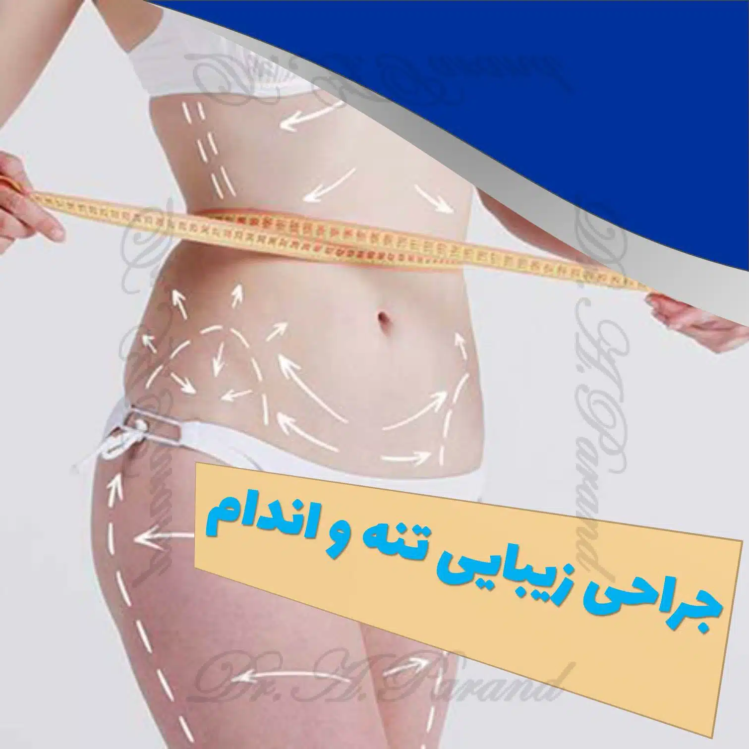 پیکرتراشی و ابدومینوپلاستی دکتر پرند