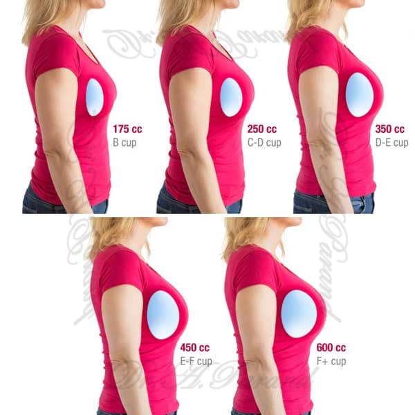 انواع سایز پروتز سینه