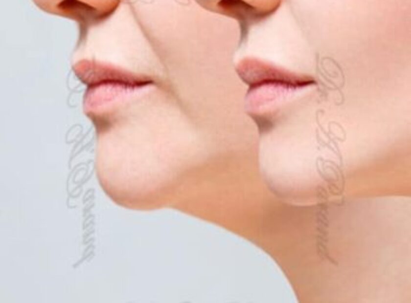 غ4 e1736241304839 دکتر علی پرند فوق تخصص جراحی پلاستیک زیبایی و ترمیمی