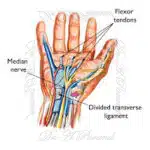 آسیب عصب دست| علت، علائم| تشخیص و روش های درمانی